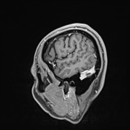 Click on the Serie image to view the images of VILLANUEVA, WILLIAM A.